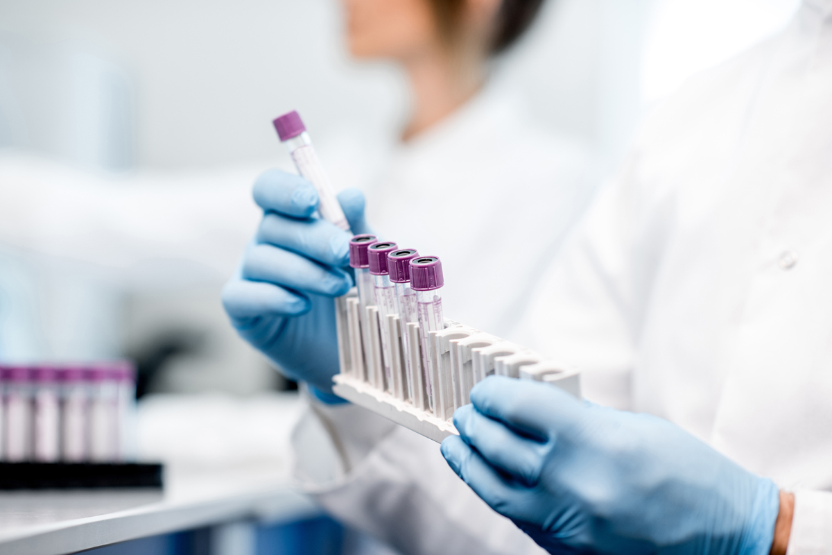 A doctor wearing gloves handles vials as part of the bloodwork process for functional medicine fertility testing.